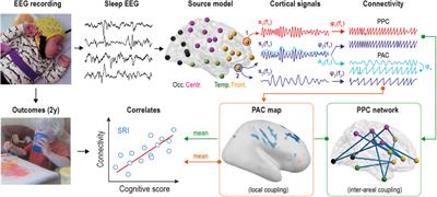 Cortical Cross-Frequency Coupling Is Affected by in utero Exposure to Antidepressant Medication